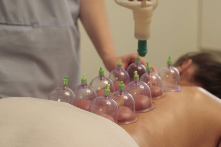 Cupping massage zelf doen? Een complete gids